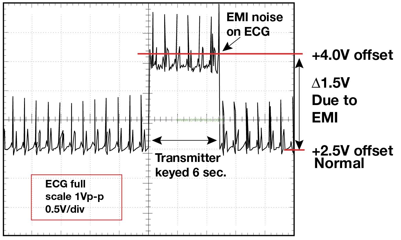 圖 1 1.5 英尺以外的發(fā)射器(f = 470 MHz, P= 0.5W)開啟和關(guān)閉時 ECG 診斷設備的心臟檢查結(jié)果