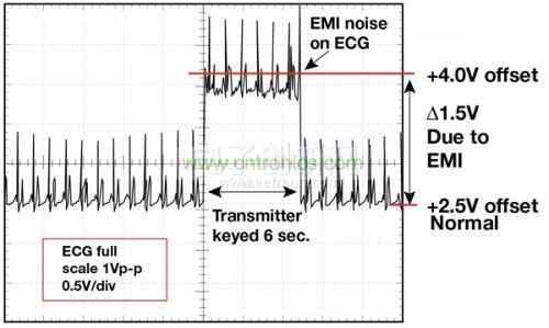 1.5 英尺以外的發射器(f = 470 MHz, P= 0.5W)開啟和關閉時ECG 診斷設備的心臟檢查結果