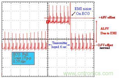 圖 1:醫用 ECG 測量設備的性能