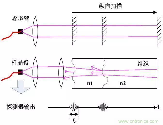 解讀光學相干層析成像技術